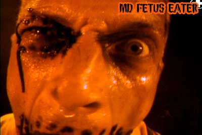 md fetus eater