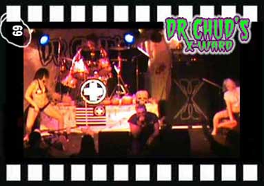 Dr.Chud's X-Ward